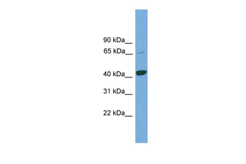 KCTD9 Rabbit Polyclonal Antibody