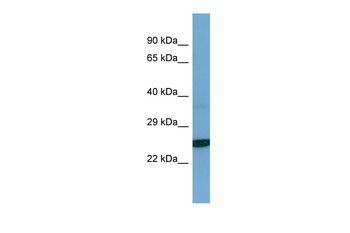 TESC Rabbit Polyclonal Antibody