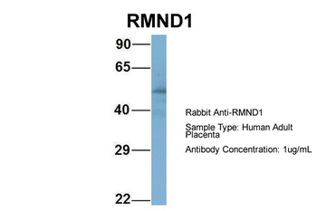 RMND1 Rabbit Polyclonal Antibody