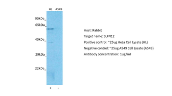 SLFN12 Rabbit Polyclonal Antibody