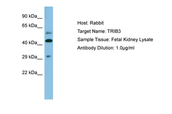 TRIB3 Rabbit Polyclonal Antibody