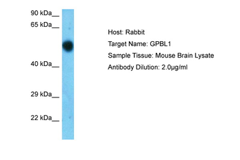 Gpbp1l1 Rabbit Polyclonal Antibody