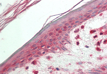 VPS52 Rabbit Polyclonal Antibody