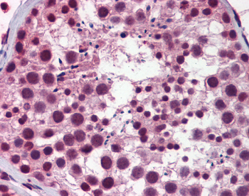 NASP Rabbit Polyclonal Antibody