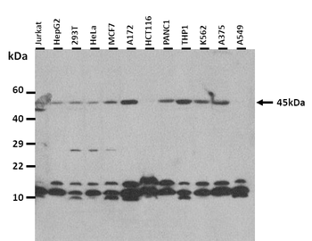 ASAH1 Rabbit Polyclonal Antibody