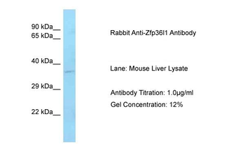 Zfp36l1 Rabbit Polyclonal Antibody