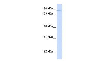 TBX2 Rabbit Polyclonal Antibody