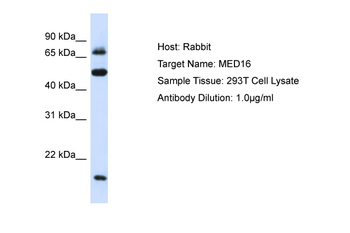 MED16 Rabbit Polyclonal Antibody