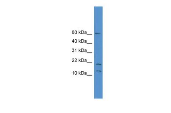 SNAPC5 Rabbit Polyclonal Antibody