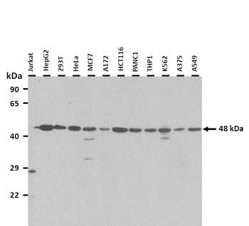 TRIM31 Rabbit Polyclonal Antibody