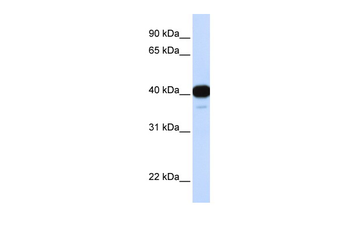 FOXL1 Rabbit Polyclonal Antibody