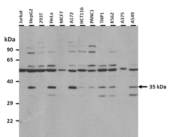 NKX3-2 Rabbit Polyclonal Antibody