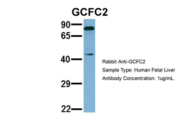C2orf3 Rabbit Polyclonal Antibody