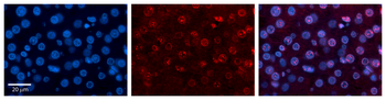 RUNX1T1 Rabbit Polyclonal Antibody