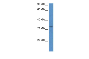 Jmjd8 Rabbit Polyclonal Antibody
