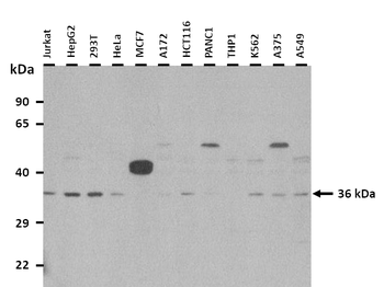 TSTA3 Rabbit Polyclonal Antibody