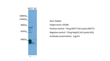 ATG9B Rabbit Polyclonal Antibody