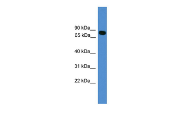 ITIH1 Rabbit Polyclonal Antibody