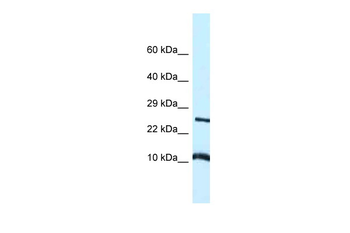 Vamp8 Rabbit Polyclonal Antibody