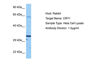 CRY1 Rabbit Polyclonal Antibody