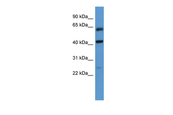 GPRC5B Rabbit Polyclonal Antibody