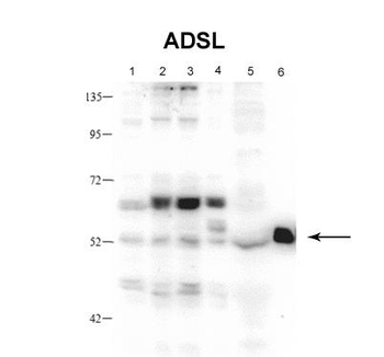 ADSL Rabbit Polyclonal Antibody