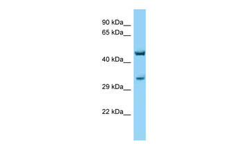 Cnr1 Rabbit Polyclonal Antibody