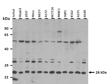 C1QA Rabbit Polyclonal Antibody