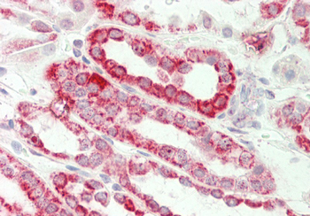 MGST3 Rabbit Polyclonal Antibody