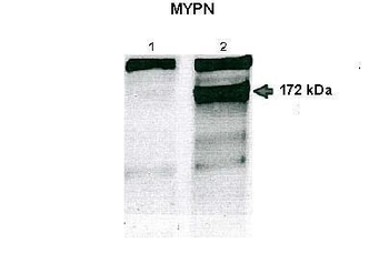 MYPN Rabbit Polyclonal Antibody
