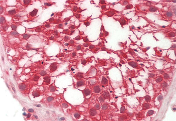 RHBDD1 Rabbit Polyclonal Antibody