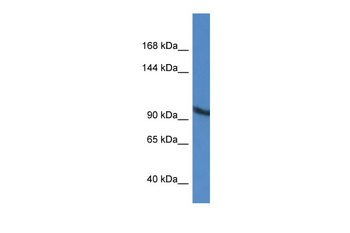 ZMIZ2 Rabbit Polyclonal Antibody