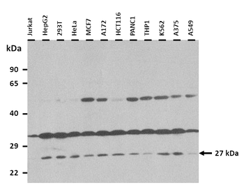 IL32 Rabbit Polyclonal Antibody