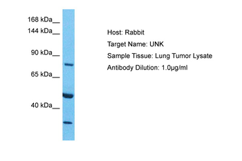 UNK Rabbit Polyclonal Antibody