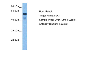 KLC1 Rabbit Polyclonal Antibody