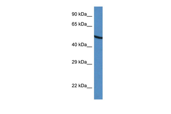 UGDH Rabbit Polyclonal Antibody