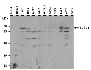 EIF2B5 Rabbit Polyclonal Antibody
