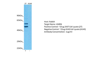 AMBN Rabbit Polyclonal Antibody
