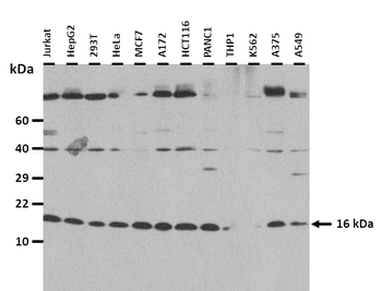 UBE2V1 Rabbit Polyclonal Antibody