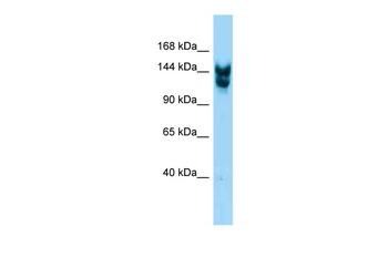 Nup160 Rabbit Polyclonal Antibody