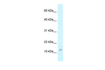RPL37 Rabbit Polyclonal Antibody
