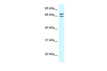 CNKSR1 Rabbit Polyclonal Antibody
