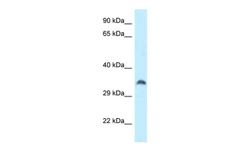 CPPED1 Rabbit Polyclonal Antibody