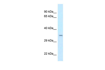 CPPED1 Rabbit Polyclonal Antibody