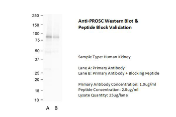 PLPBP Rabbit Polyclonal Antibody
