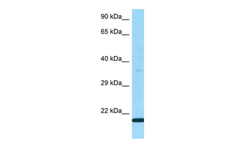 LY6G5B Rabbit Polyclonal Antibody