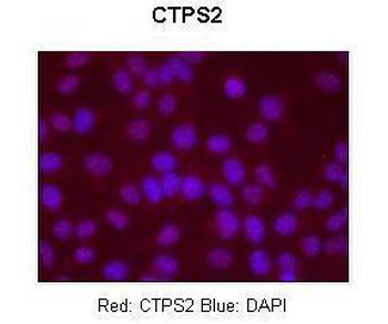 CTPS2 Rabbit Polyclonal Antibody