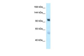 EDEM3 Rabbit Polyclonal Antibody