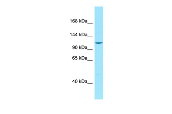 LIMCH1 Rabbit Polyclonal Antibody