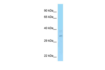 RPRD1A Rabbit Polyclonal Antibody